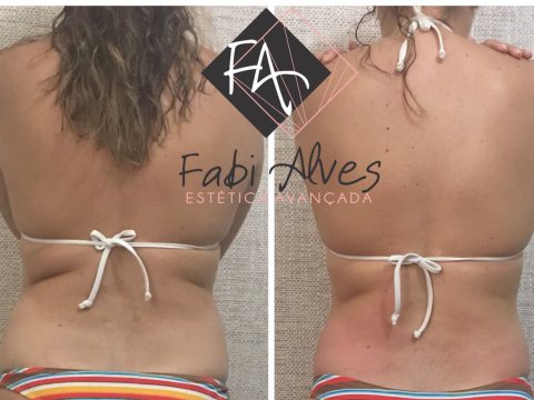 Fabí Alves Estética Avançada - estética e massagem no bairro Betânia — foto 2