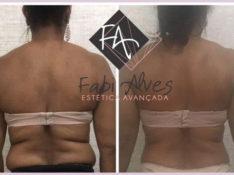 Fabí Alves Estética Avançada - estética e massagem no bairro Betânia — foto 3