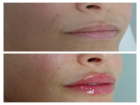 Dra Cida Oliveira Estética Avançada — foto 4