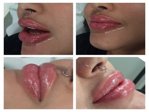 Dra Cida Oliveira Estética Avançada — foto 5