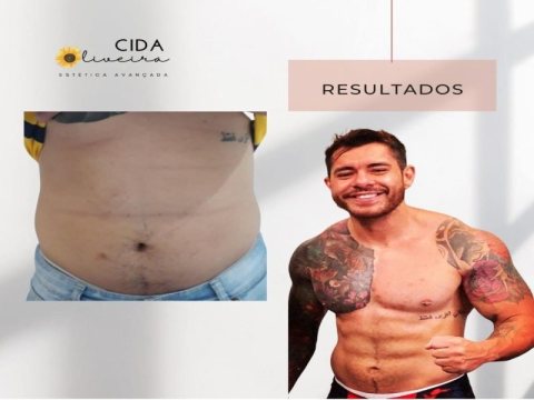 Dra Cida Oliveira Estética Avançada — foto 12