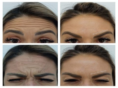 Dra Cida Oliveira Estética Avançada — foto 6